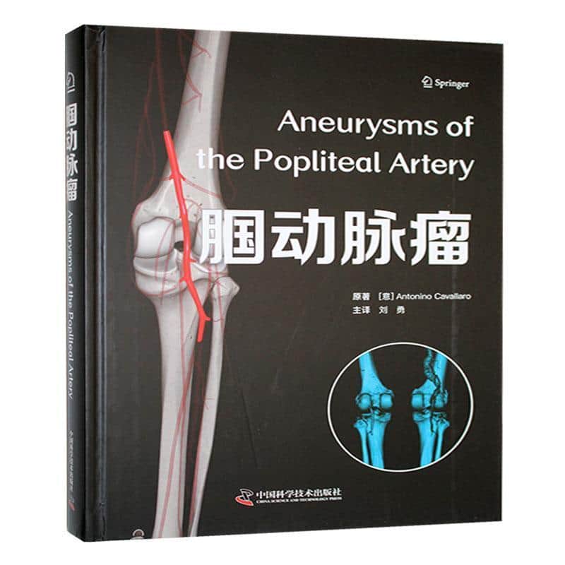 腘动脉瘤
