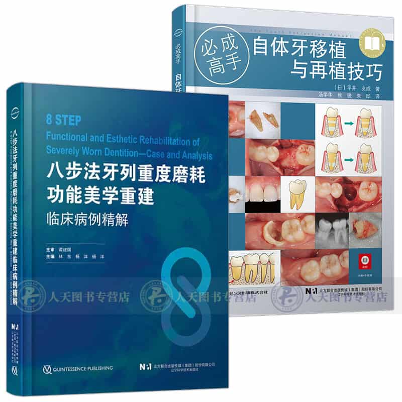 三步法牙齿磨耗微创修复