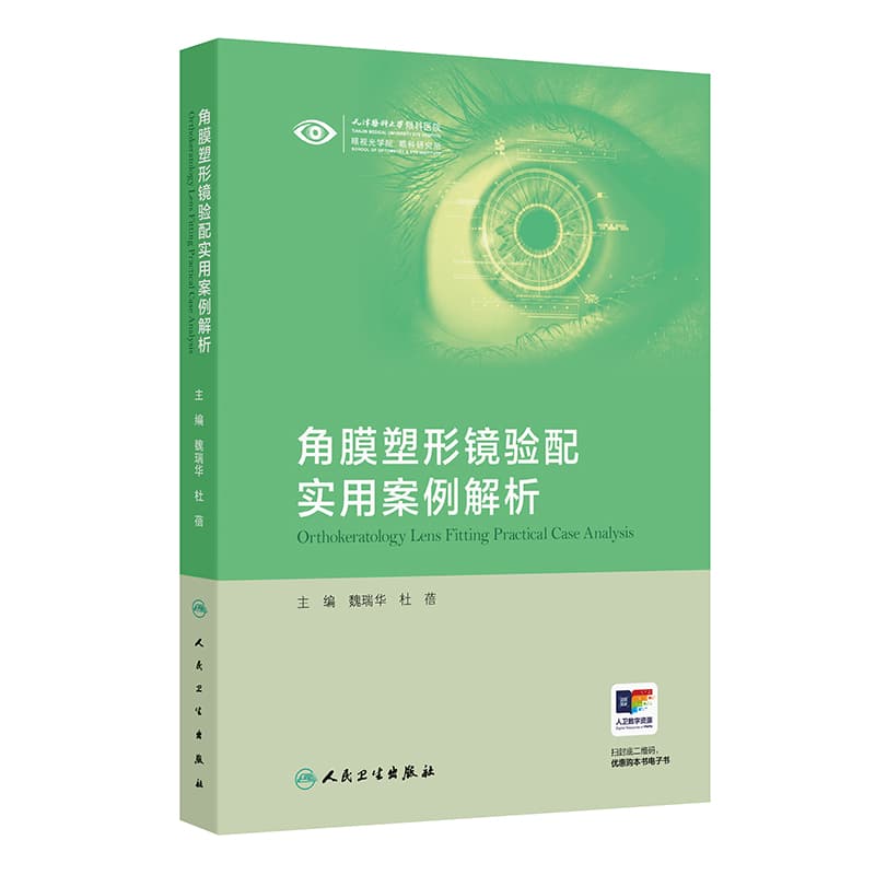 角膜塑形镜验配实用案例解析