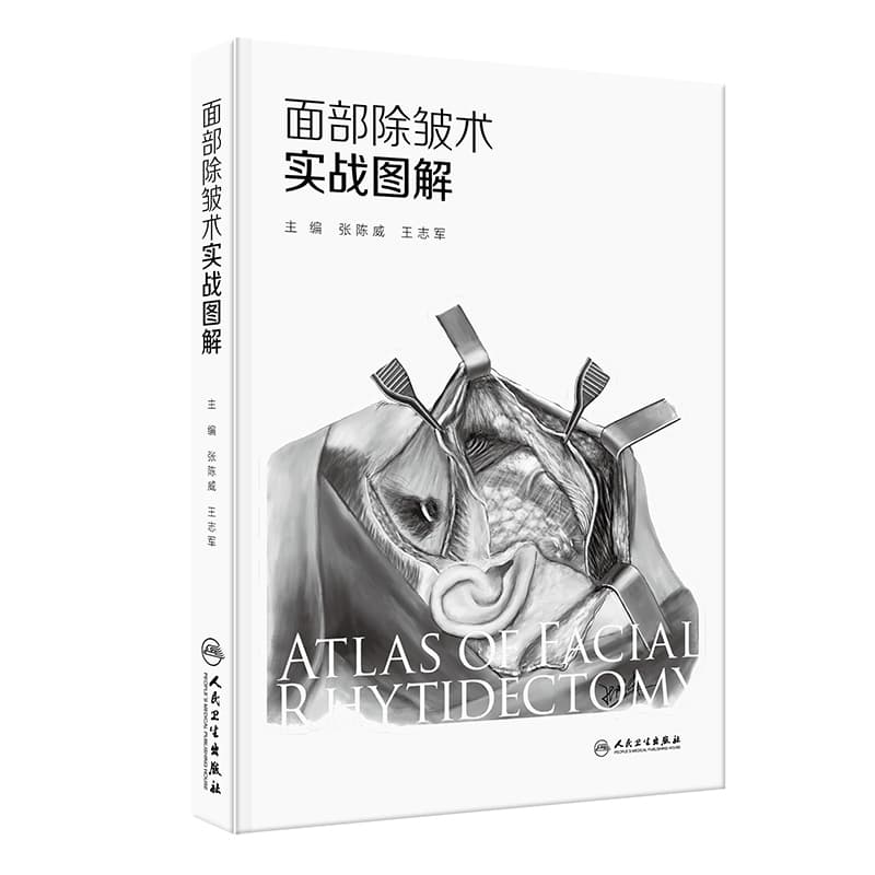 面部除皱术实战图解