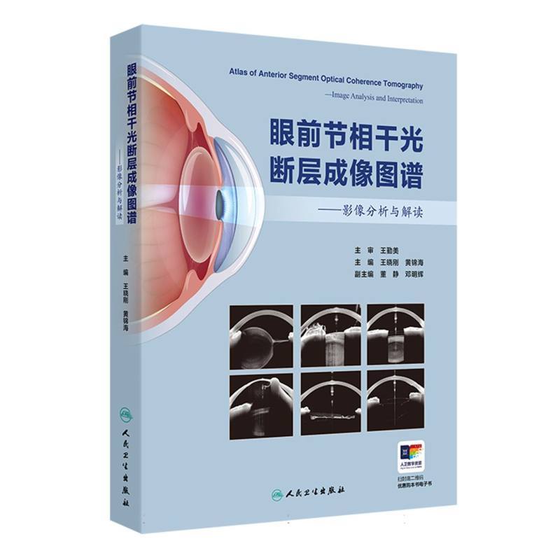 眼前节相干光断层成像图谱—影像分析与解读