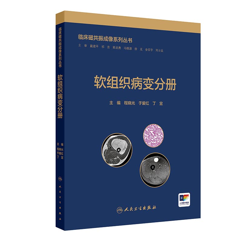 临床磁共振成像系列丛书:软组织病变分册