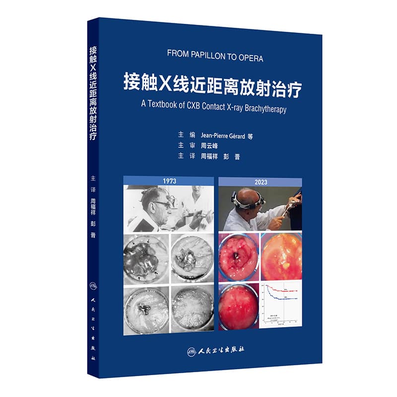 接触X线近距离放射治疗