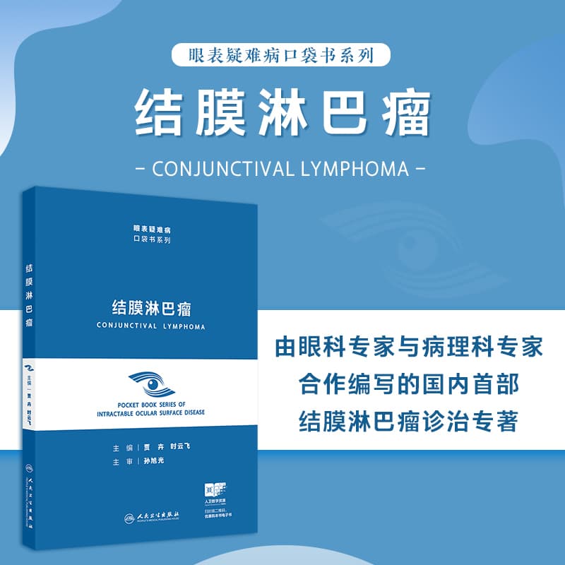 结膜淋巴瘤
