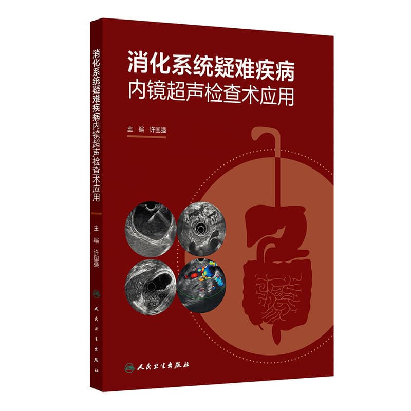 消化系统疑难疾病内镜超声检查术应用