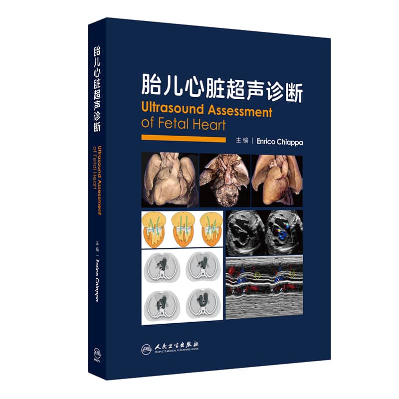 胎儿心脏超声诊断