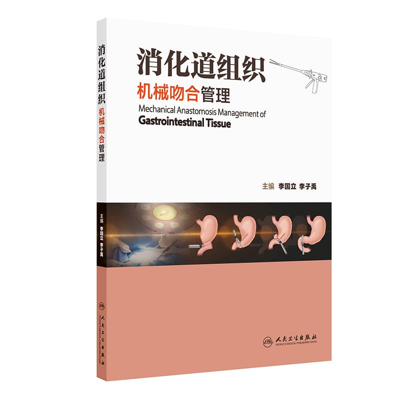 消化道组织机械吻合管理
