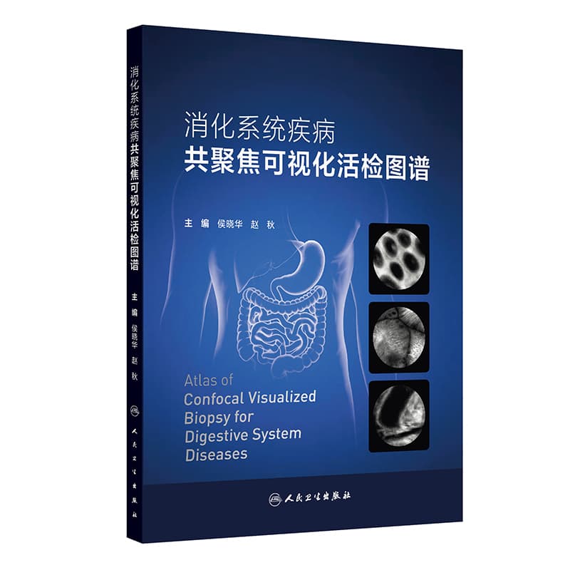 消化系统疾病共聚焦可视化活检图谱
