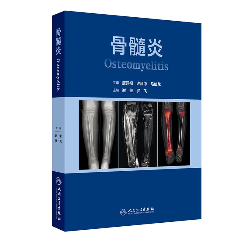 骨髓炎