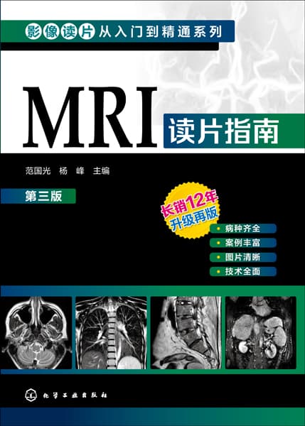 MRI读片指南