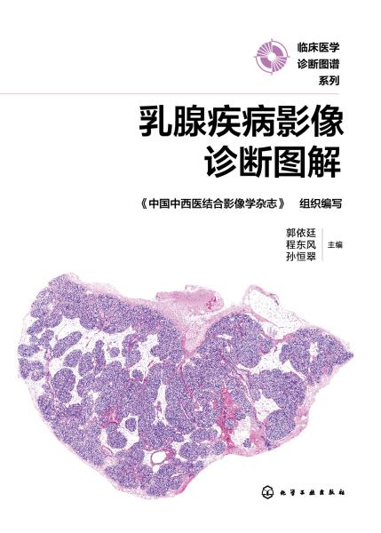 乳腺疾病影像诊断图解