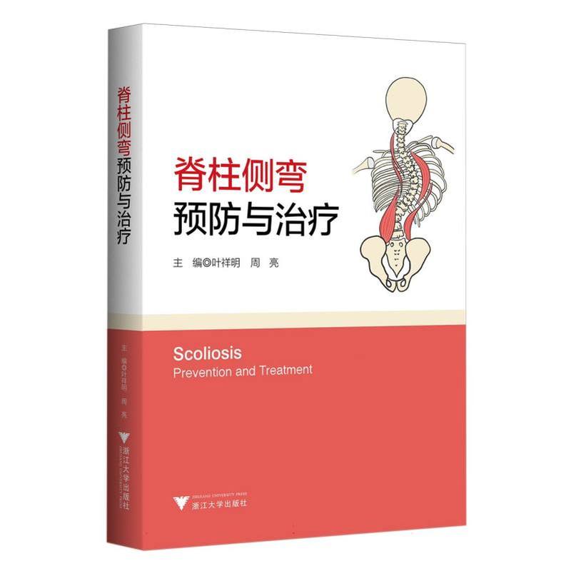 脊柱侧弯—预防与治疗