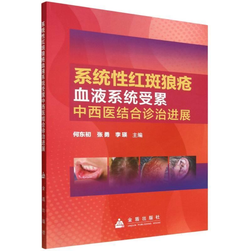 系统性红斑狼疮血液系统受累中西医结合诊治进展