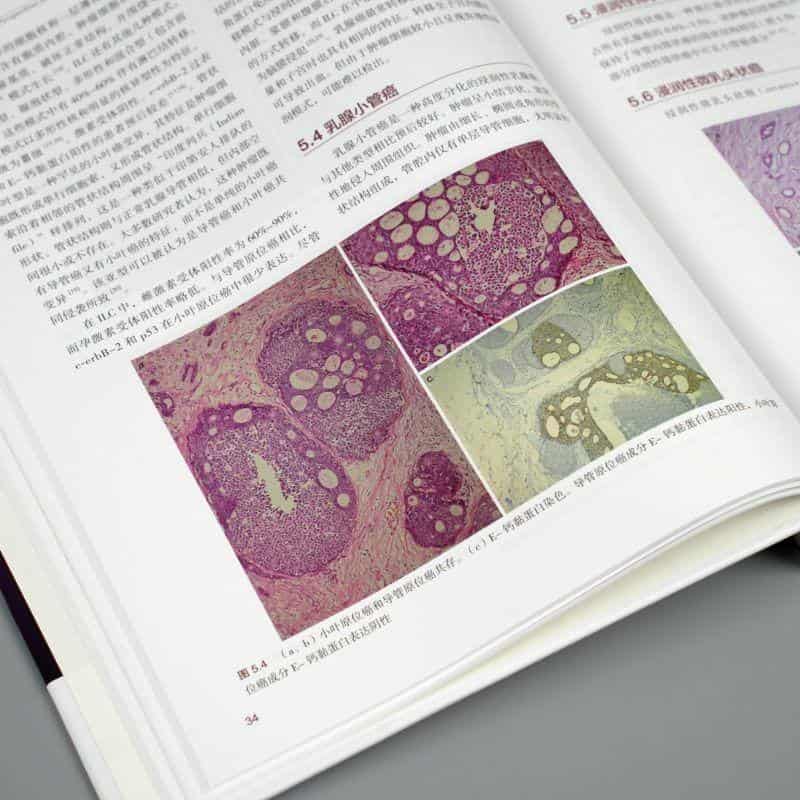 乳腺癌精要—外科观点