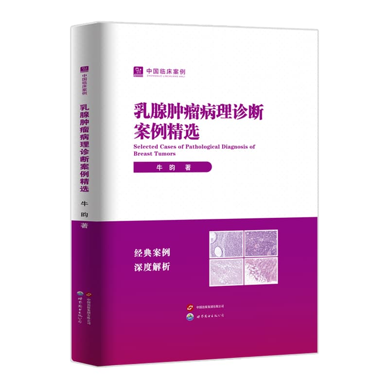 乳腺肿瘤病理诊断案例精选