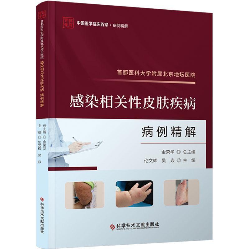 首都医科大学附属北京地坛医院感染相关性皮肤疾病病例精解