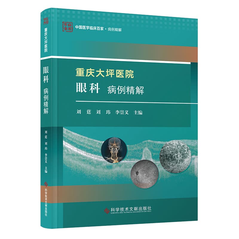 重庆大坪医院眼科病例精解