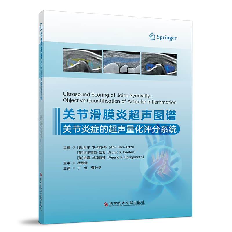 关节滑膜炎超声图谱—关节炎症的超声量化评分系统