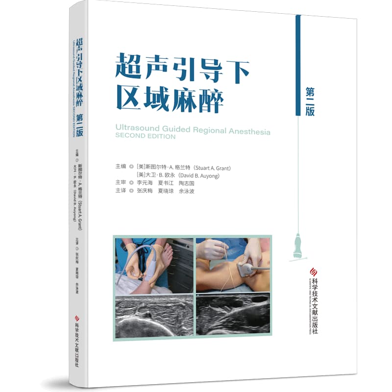 超声引导下区域麻醉