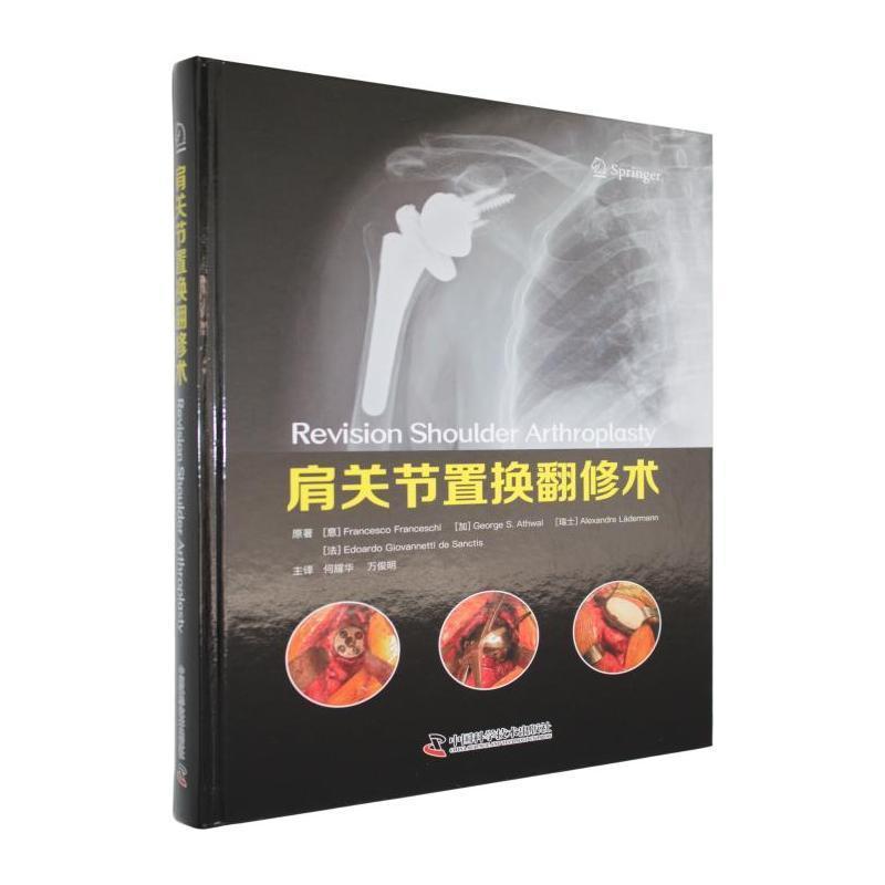 肩关节置换翻修术