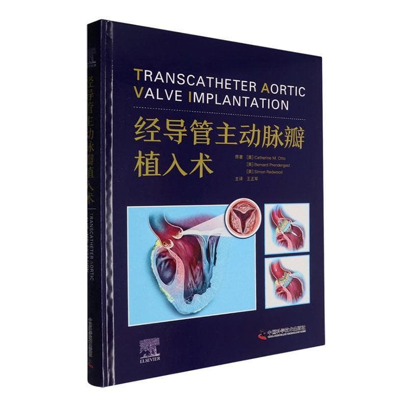 经导管主动脉瓣植入术
