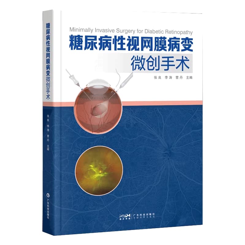 糖尿病性视网膜病变微创手术