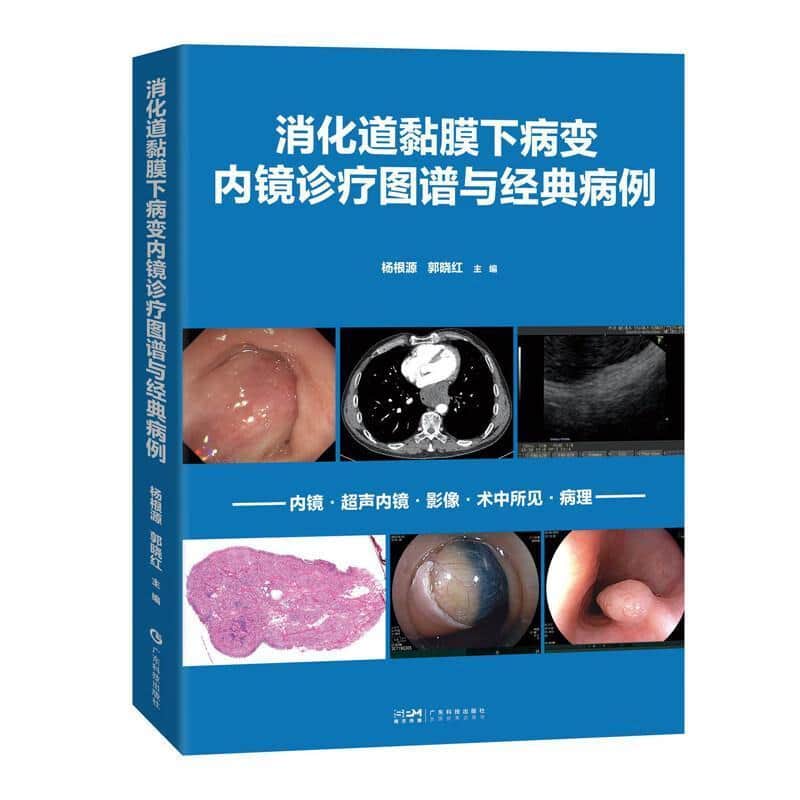 消化道黏膜下病变内镜诊疗图谱与经典病例