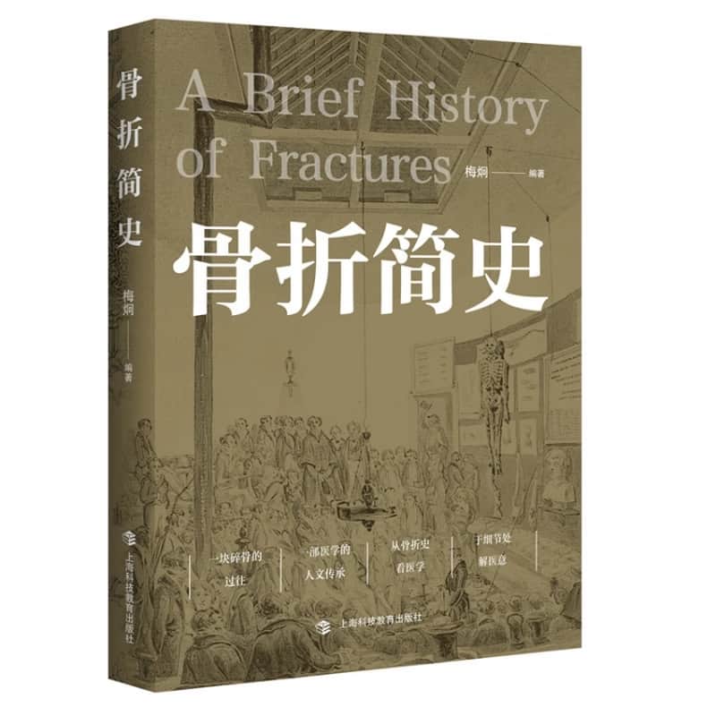 骨折简史