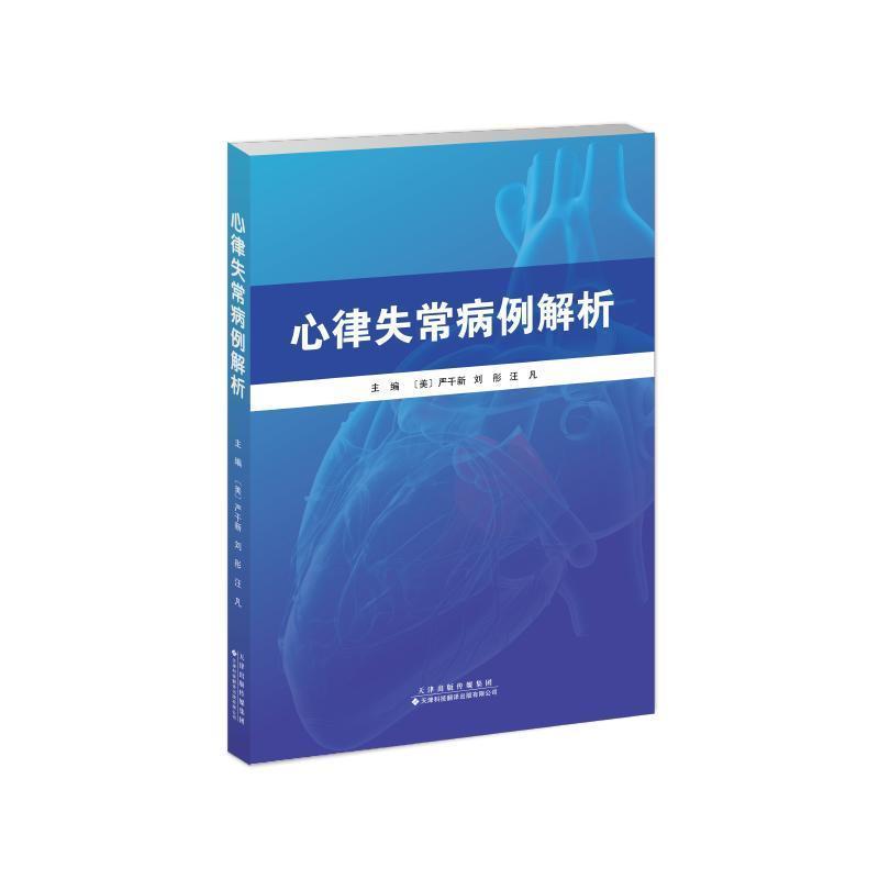 心律失常病例解析