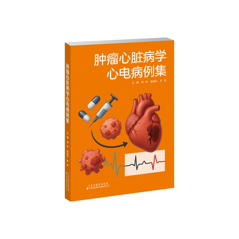 肿瘤心脏病学心电病例集