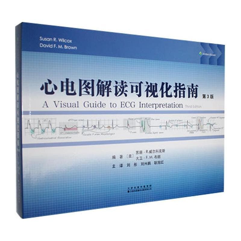 心电图解读可视化指南