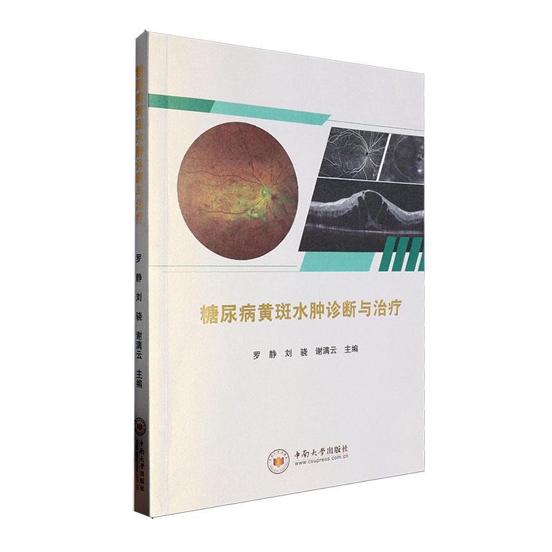 糖尿病黄斑水肿诊断与治疗
