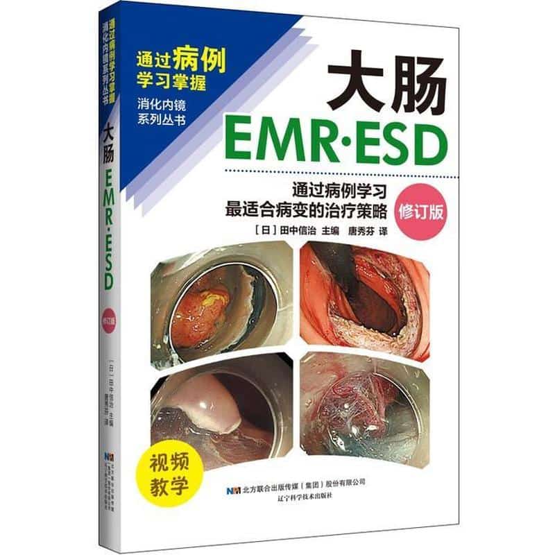 大肠EMR·ESD—通过病例学习最适合病变的治疗策略