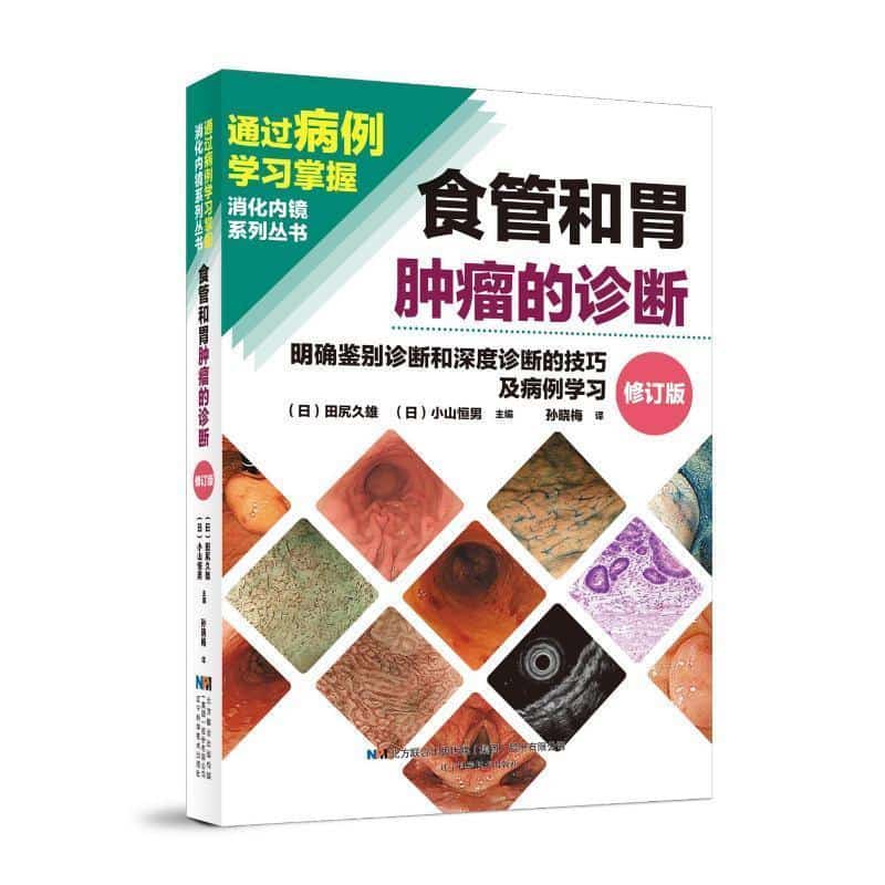食管和胃肿瘤的诊断—明确鉴别诊断和深度诊断的技巧及病例学习