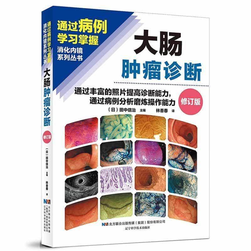 大肠肿瘤诊断