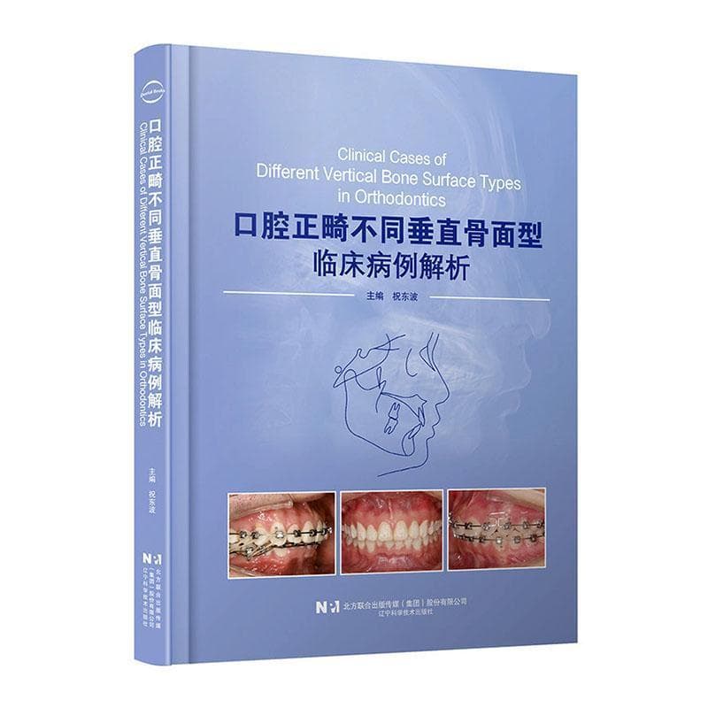 口腔正畸不同垂直骨面型临床病例解析