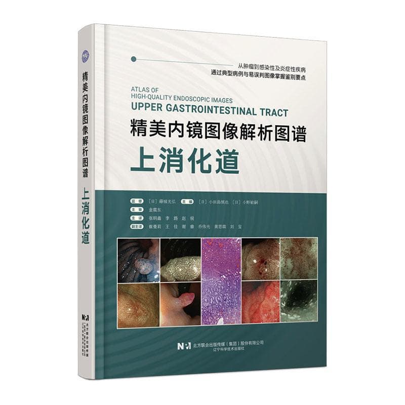 上消化道内镜诊断图谱