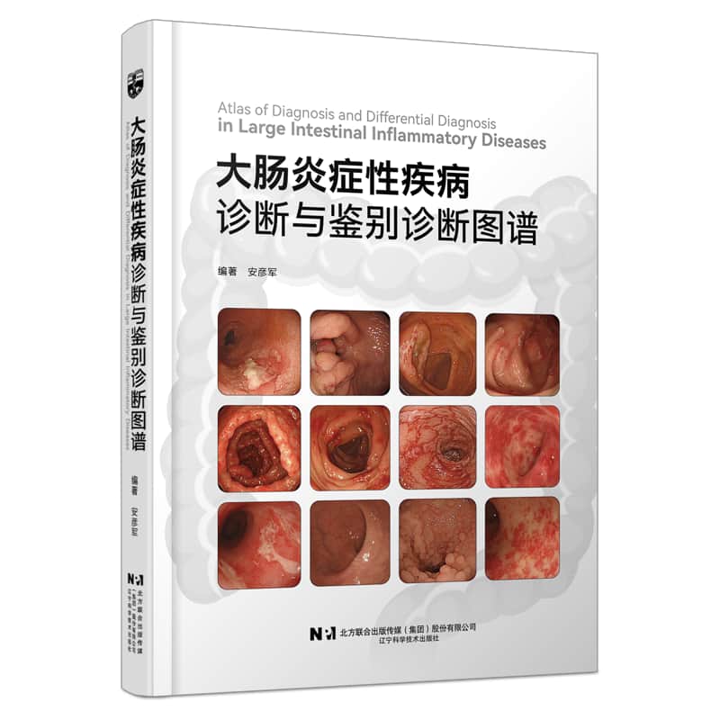 大肠炎症性疾病诊断与鉴别诊断图谱