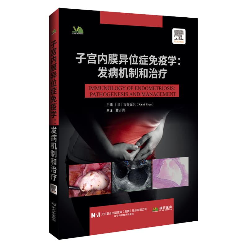 子宫内膜异位症免疫学—发病机制和治疗—pathogenesis and management