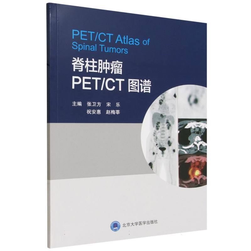 脊柱肿瘤PET/CT图谱