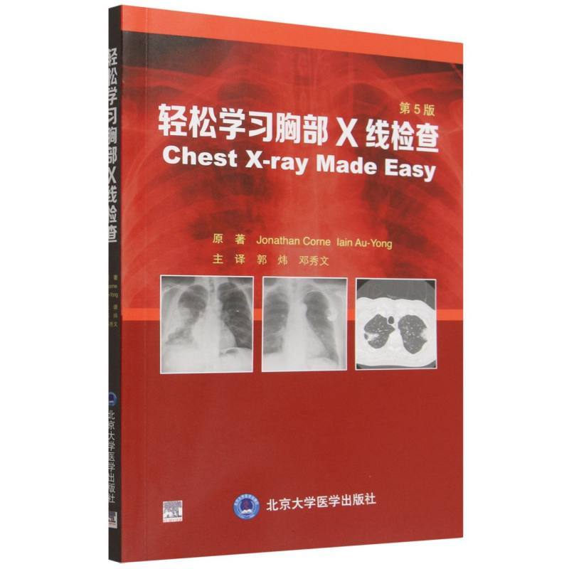 轻松学习胸部X线检查