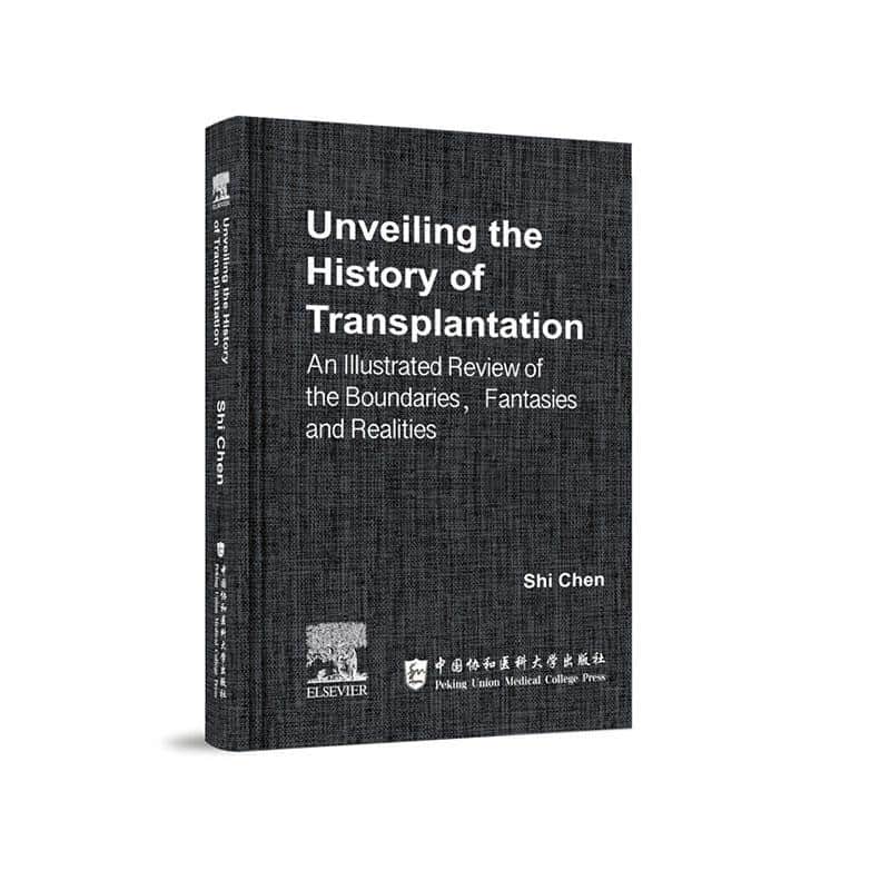Unveiling the history of transplantation—an illustrated review of the boundaries, fantasies and realities