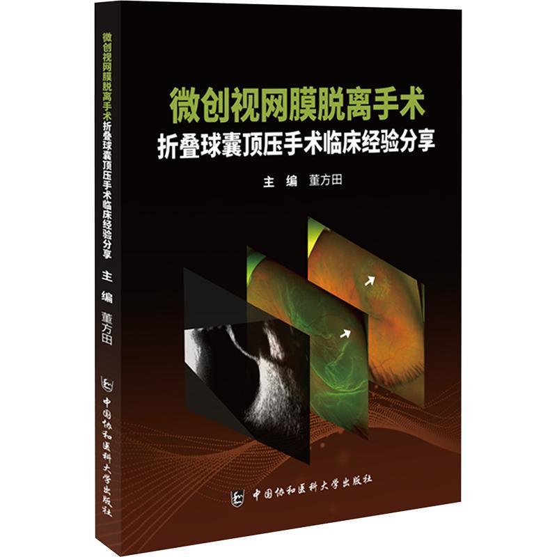微创视网膜脱离手术—折叠球囊顶压手术临床经验分享