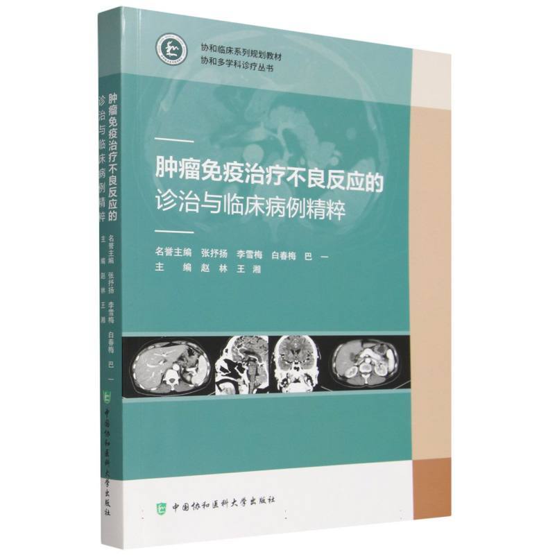 肿瘤免疫治疗不良反应的诊治与临床病例精粹