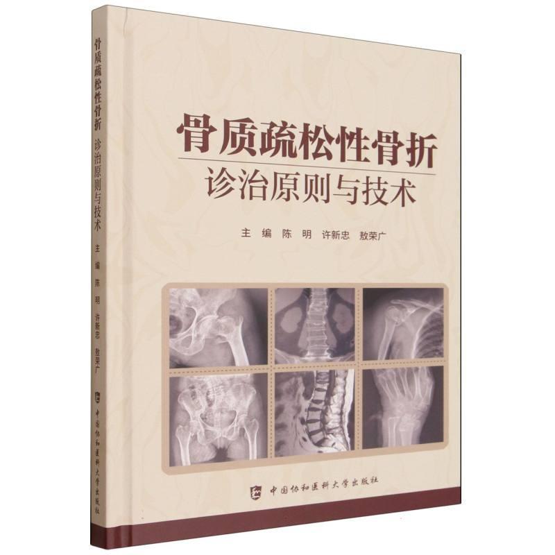 骨质疏松性骨折—诊治原则与技术