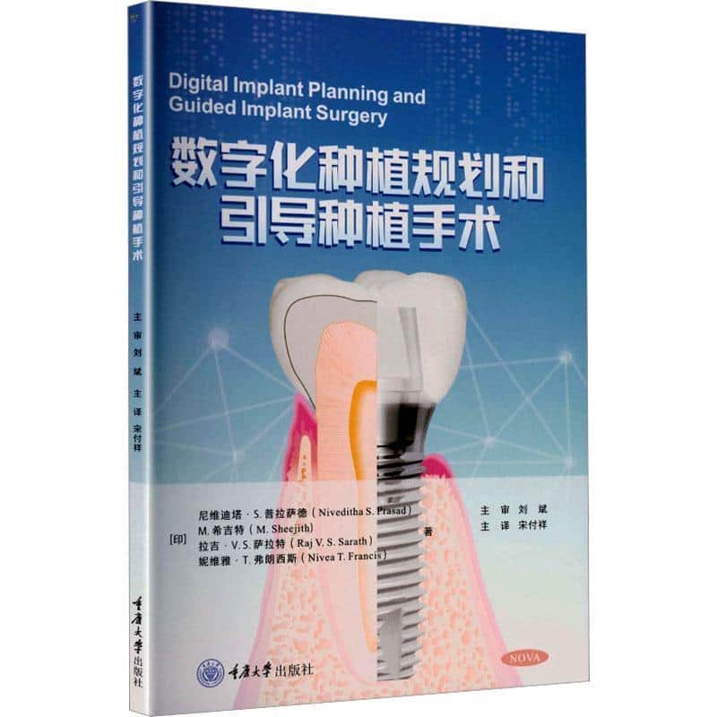 数字化种植规划和引导种植手术