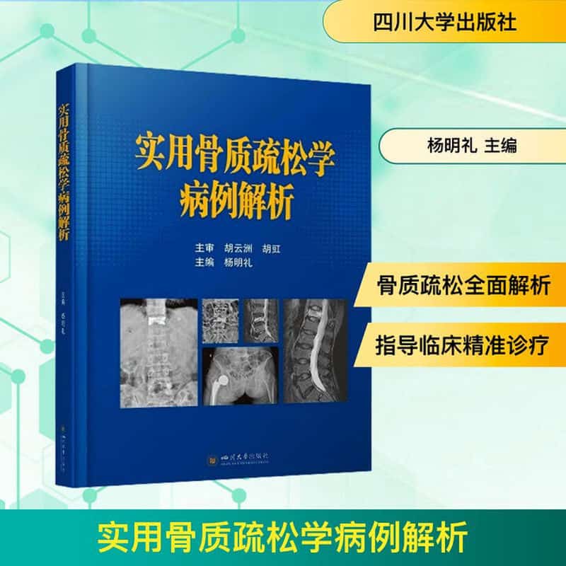 实用骨质疏松学病例解析