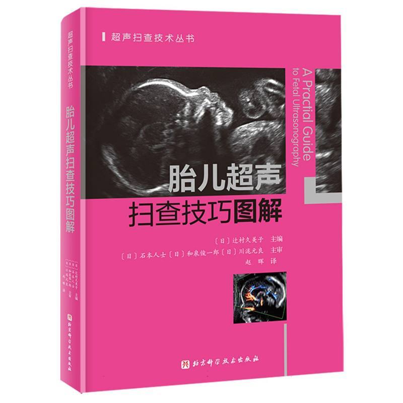 胎儿超声扫查技巧图解