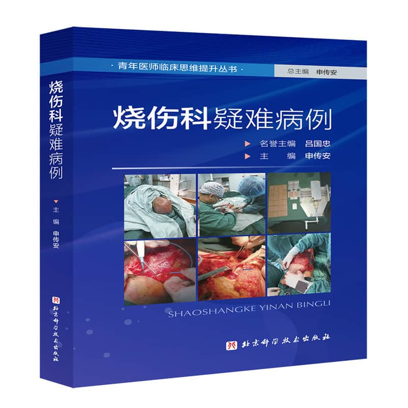 烧伤科疑难病例