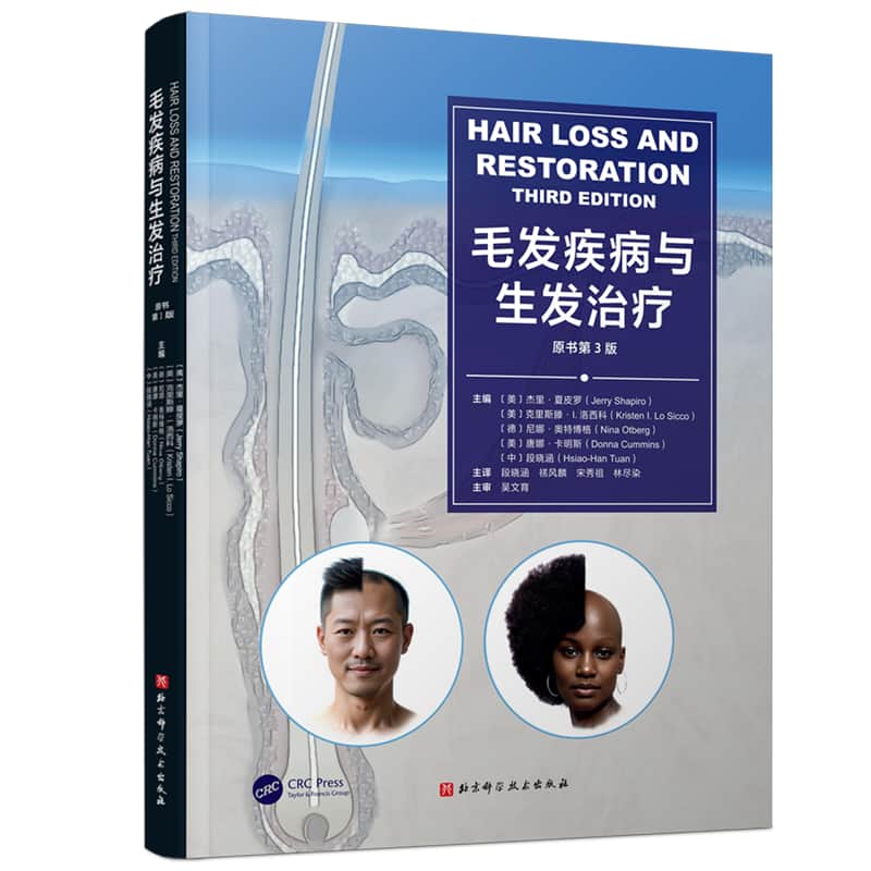 毛发疾病与生发治疗